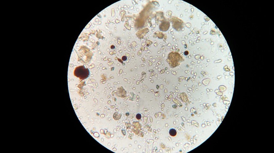 Pluton Biosciences received financing to find the new uses for microbes in agriculture